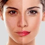 Skin Retouching